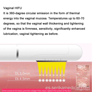 Portátil 4D HIFU Vaginal Spreening Mahcine